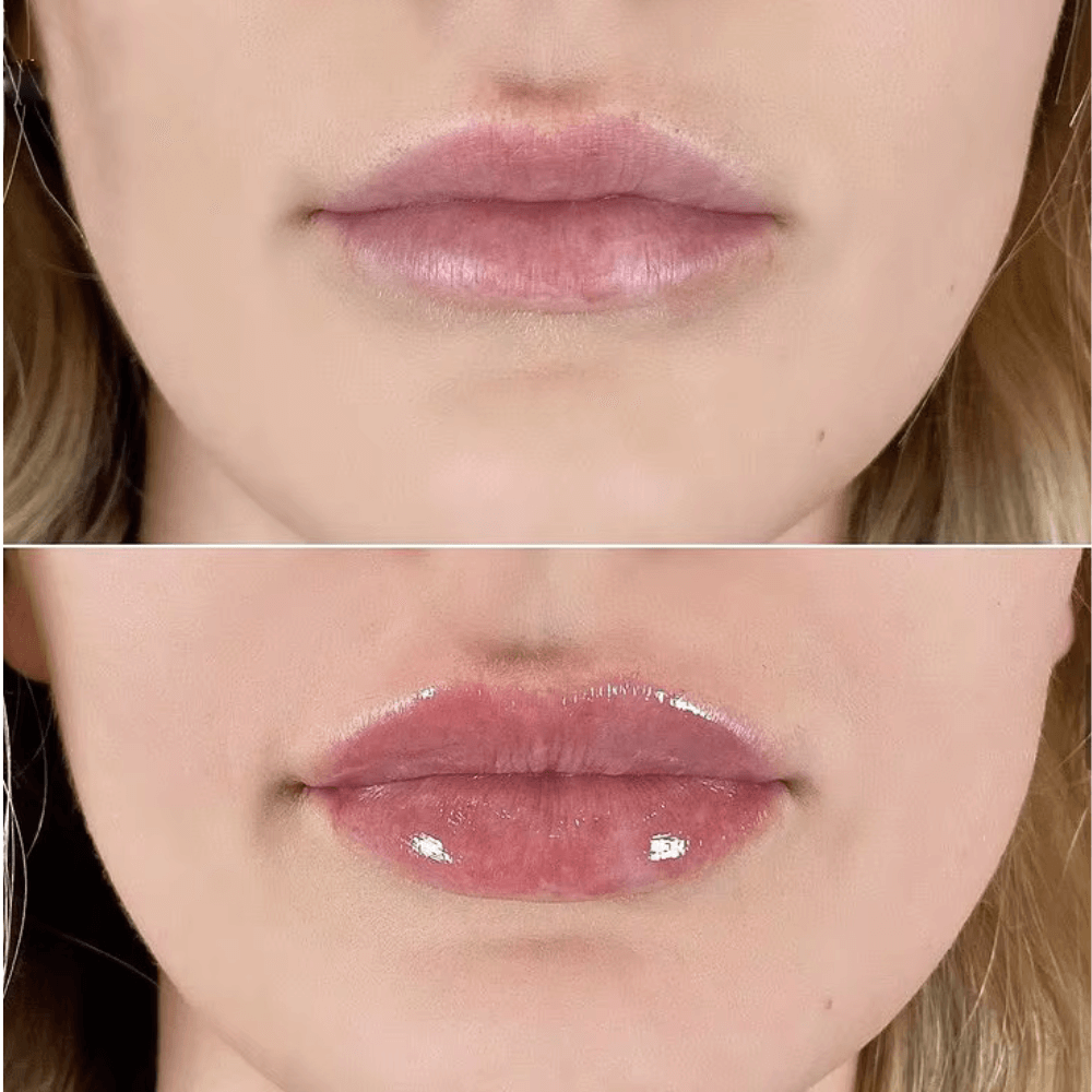 City Lips® Clear 🫦